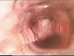 Big teen bobbed suce ...